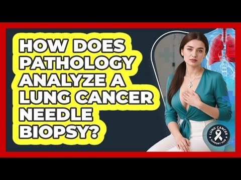 How Does Pathology Analyze A Lung Cancer Needle Biopsy? - Lung Cancer Support Hub