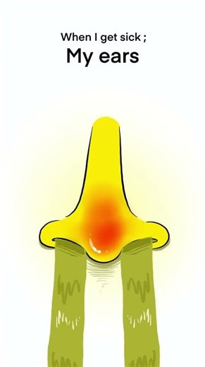 When i get sick 🤧 #meme #shorts