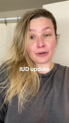 Five Months After My Mirena IUD Insertion