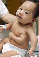 Baby with three arms