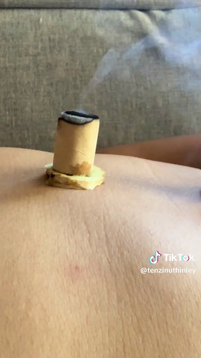 Benefits of Moxa Therapy for Health