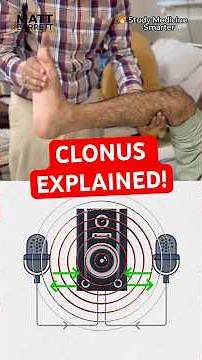 Easily remember clonus for your medical exams