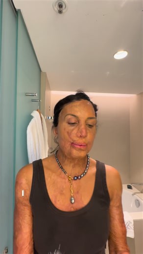 Whilst I luv the idea of resilience I feel like we (society) can use it as a band-aid for any type of problem. Rather than thinking about fixing systems or the way our society operates, we say, ‘hey all you need to be is more resilient’. What do you think? Do you think the idea of resilience is empowering? Or another way to shift blame? What else would you add? Lmk in the comments 👇🏾 | Turia Pitt