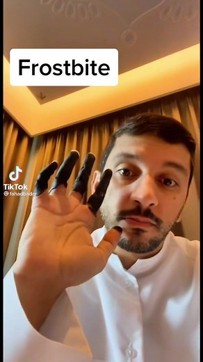 Understanding Frostbite: Causes and Symptoms Explained