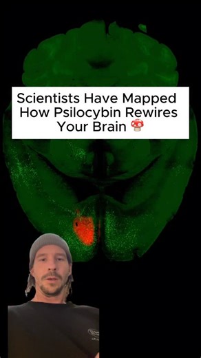 Mushies on Instagram: "Psilocybin appears to weaken cortico-cortical feedback loops (the circuits that keep signals bouncing endlessly around the cortex) while strengthening pathways that route sensory information toward subcortical regions that turn perception into action. Alex Kwan says: “Rumination is one of the main features of depression, where people keep dwelling on the same negative thoughts. By reducing some of these feedback loops, our findings are consistent with the idea that psilocy