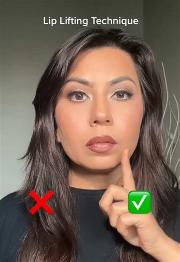 Lip Lifting Technique for a Youthful Face