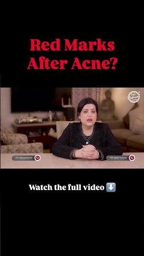 Struggling With Persistent Red Marks? Azelaic Acid May Help! ✨