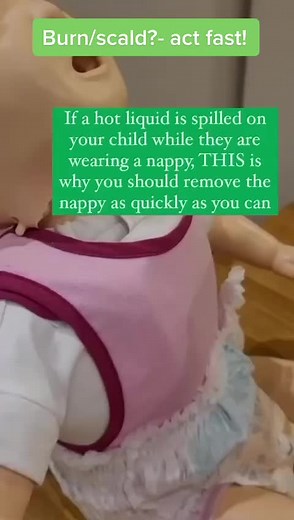 Remeber in burns or scalds to remove the nappy ASAP #minifirstaidsheffield #minifirstaid #baby #parentingtips #parentingskills #burn #scald #hotwater #firstaid #babyfirstaid #parentandbaby