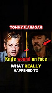 4.2K views · 18 reactions | What Really Happened to Tommy Flanagan - Chibs Telford from Sons of Anarchy? #soa #sonsofanarchy #TommyFlanagan #ChibsTelford #CelebritiesOfUSA | Celebrities of USA | Facebook