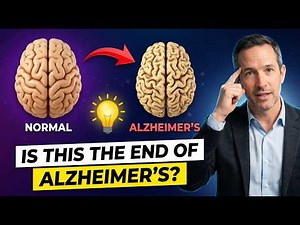 7 POWERFUL TIPS TO PREVENT ALZHEIMER'S!