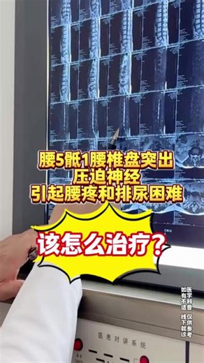 腰5骶1椎间盘突出压迫神经 导致引起腰疼和排尿困难，该怎么治疗？ #腰椎间盘突出症 #腰椎间盘突出 #腰椎病 #腰腿痛 #抖出健康知识宝藏