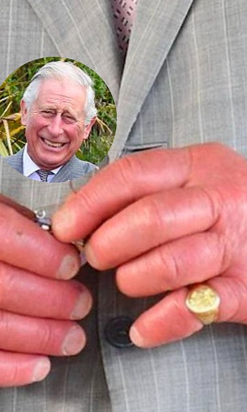 Here's why King Charles's fingers are so big