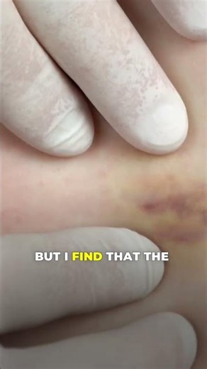 Testosterone Injections vs Creams Which is Best for Men’s Health #shorts