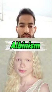 What Is Albinism? The Real Science Behind It! 👀🧬 #shorts #albinism