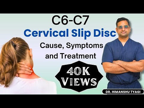 C6- C7 Cervical Slip Disc- Cause, Symptoms and Treatment.
