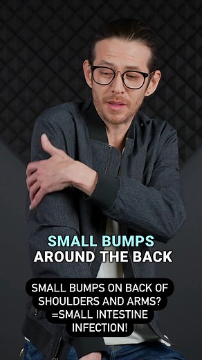 Small bumps, rashes, and acne on back of the shoulders and arms(triceps) could be associated with Small Intestine infections and toxins. SIBO (small intestine bacterial overgrowth) can create inflammation along the small Intestine meridian. The meridian goes up back of arm, shoulder blade, neck, and along upper cheek bone. Digestion imbalance can definitely create skin problems in these areas. Test for SIBO( https://microgendx.com/), reduce sugars and dairy, hydrate, and cleanse with herbs. Herb