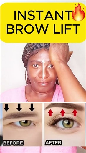 Lift Droopy Eyelids Instantly !✨