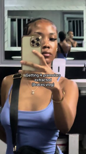 Getting 4 Premolars Extracted (Braces Vlog)