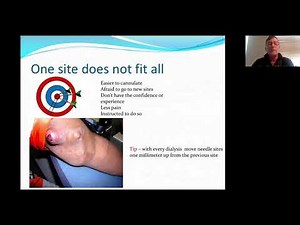 Tips on Cannulation - BC Kidney Days 2020