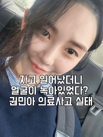 권민아 의료사고 실태: 얼굴 녹은 이유는?
