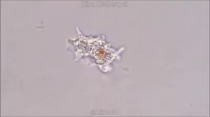 Amoeba Under A Microscope - Water Sample. Video By: Kim Ulvberget (https://www.youtube.com/channel/UC1_XuApZhnm-gidm6zS5Mcg). | Microbe Notes