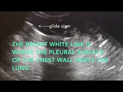 Thoracic Glide Sign- What Does It Look Like?│Veterinary Emergency Procedures