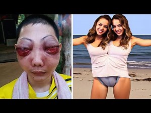 15 Most Unusual & Shocking People In The World!
