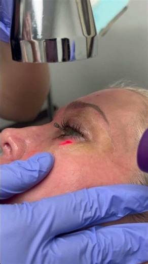 Eye Rejuvenation vs. Laser Blepharoplasty