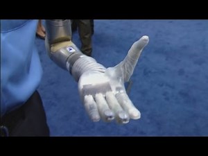 Amazing science! New robotic arm helps wounded US soldiers