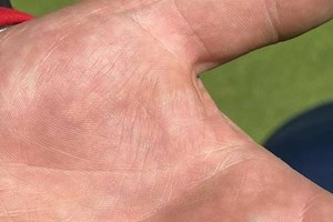 Suspected annual bluegrass weevil on golf course in Michigan