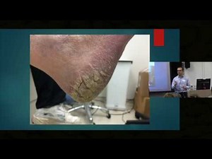 Itch in Elderly Skin - Dr. Ian Bekker