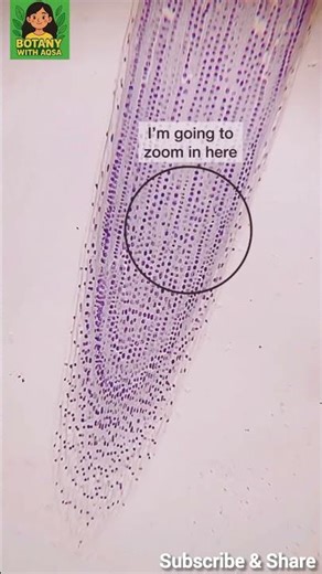 Mitosis in Onion Root Tip Cells Under Microscope | Cell Division