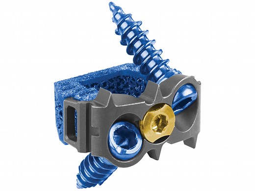 HEDRON IC™ 3D Printed Integrated ACDF Plate-Spacer | Globus Medical