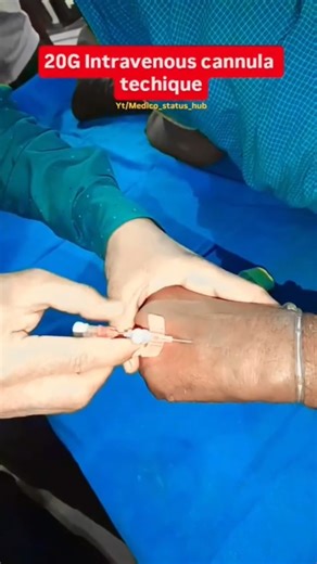 20G IV Cannulas: The Future of Blood Transfusion #Medicostatushub, #medal #Bsc nursing