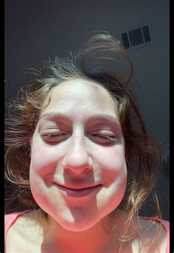 If you saw me that week….. no you didn’t. Capeesh?#widsomteethremoval #swollen #gerbil #fyp #foryoupage