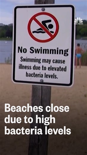 High bacteria levels cause beach closures across U.S.