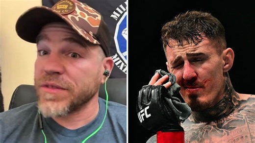 Jim Miller: 'We're probably going to see someone lose an eye in the octagon'