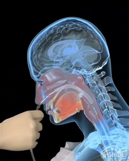 Let’s Learn- Nasogastric tube NG tube types and insertion