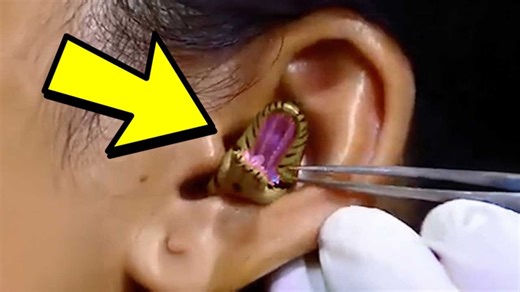 Little Girl Hears Scratching Noises In Her Head, What Doctors Discovered Shocked The World