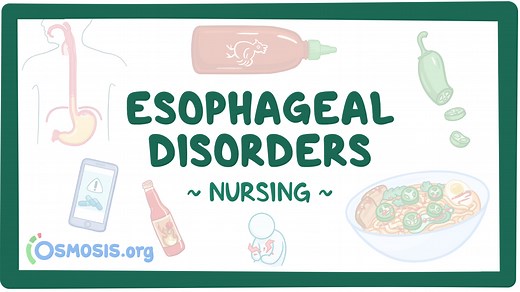Case study - Gastroesophageal reflux disease (GERD): Nursing: Video & Causes | Osmosis