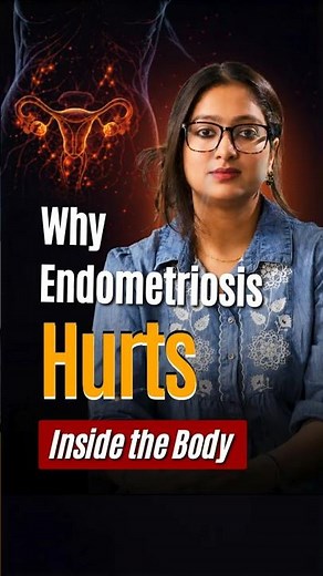 When Endometriosis Required Surgery? Robotic Techniques & Recovery Tips