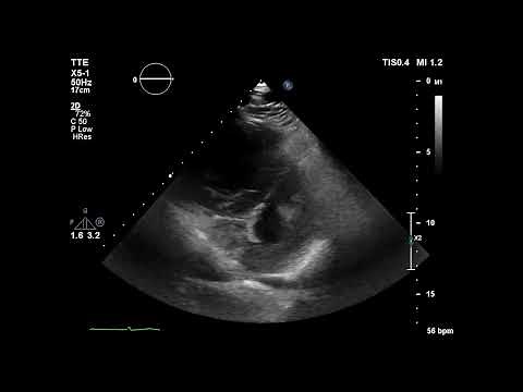 Echocardiography in 4 steps - Docteur Synapse
