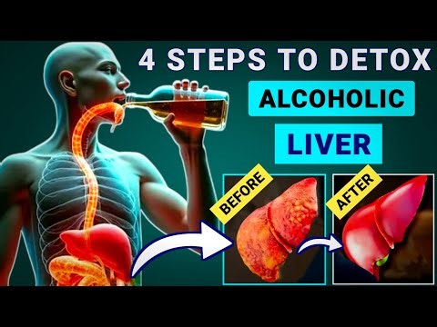 How To Detox Alcoholic Liver Easily | Liver Cleanse | Reverse Alcohol Damage & Improve Liver Health