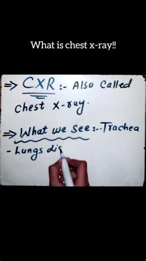 chest radiograph explained!!!! #xray #ultrasound #radiology