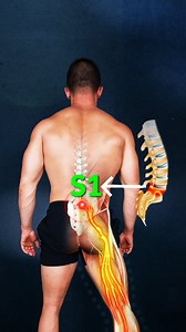 4.6M views · 40K reactions |  Your Leg Pain Isn’t Random. It’s Your...