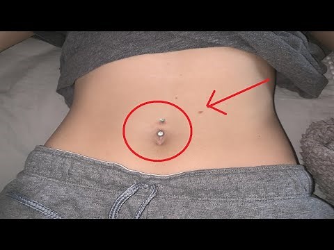 how to get rid of a belly button piercing infection fast