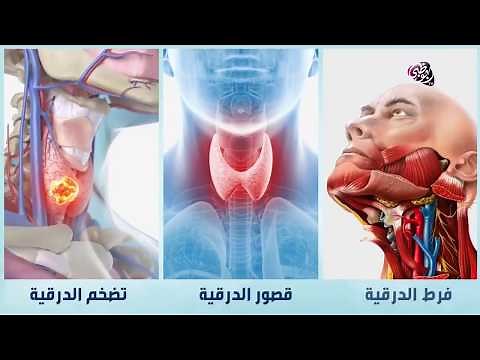 ما هي أعراض خلل الغدة الدرقية؟
