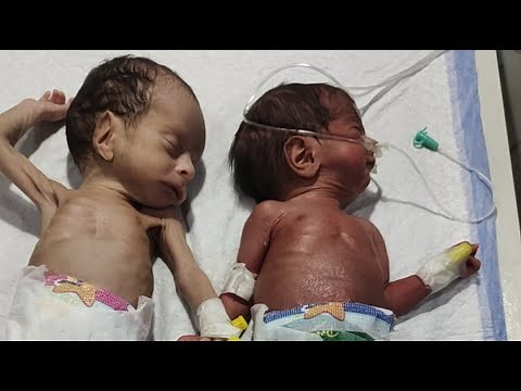 Neonatal Care Basics | Essential Newborn Tips for Parents and Nurses