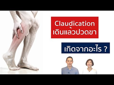 เดินแล้วปวดขา เกิดจากอะไร (Vascular vs Neurogenic claudication) | EasyDoc Family Talk EP.18