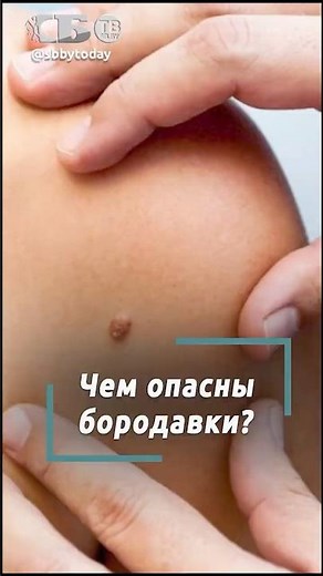 Human papillomavirus: what is it and how is it dangerous for everyone?